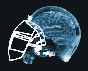 Concussions and Football helmets